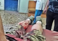 В Киеве напали на бывшего защитника ДАП